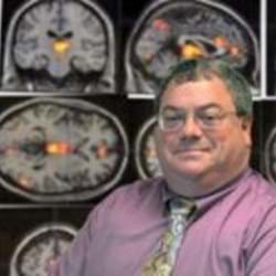 Brain Blood Flow Patterns Sexual Dysfunction