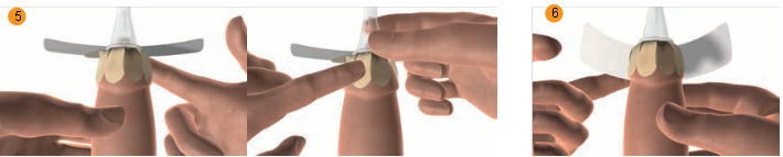 BioDerm  How to Use 2